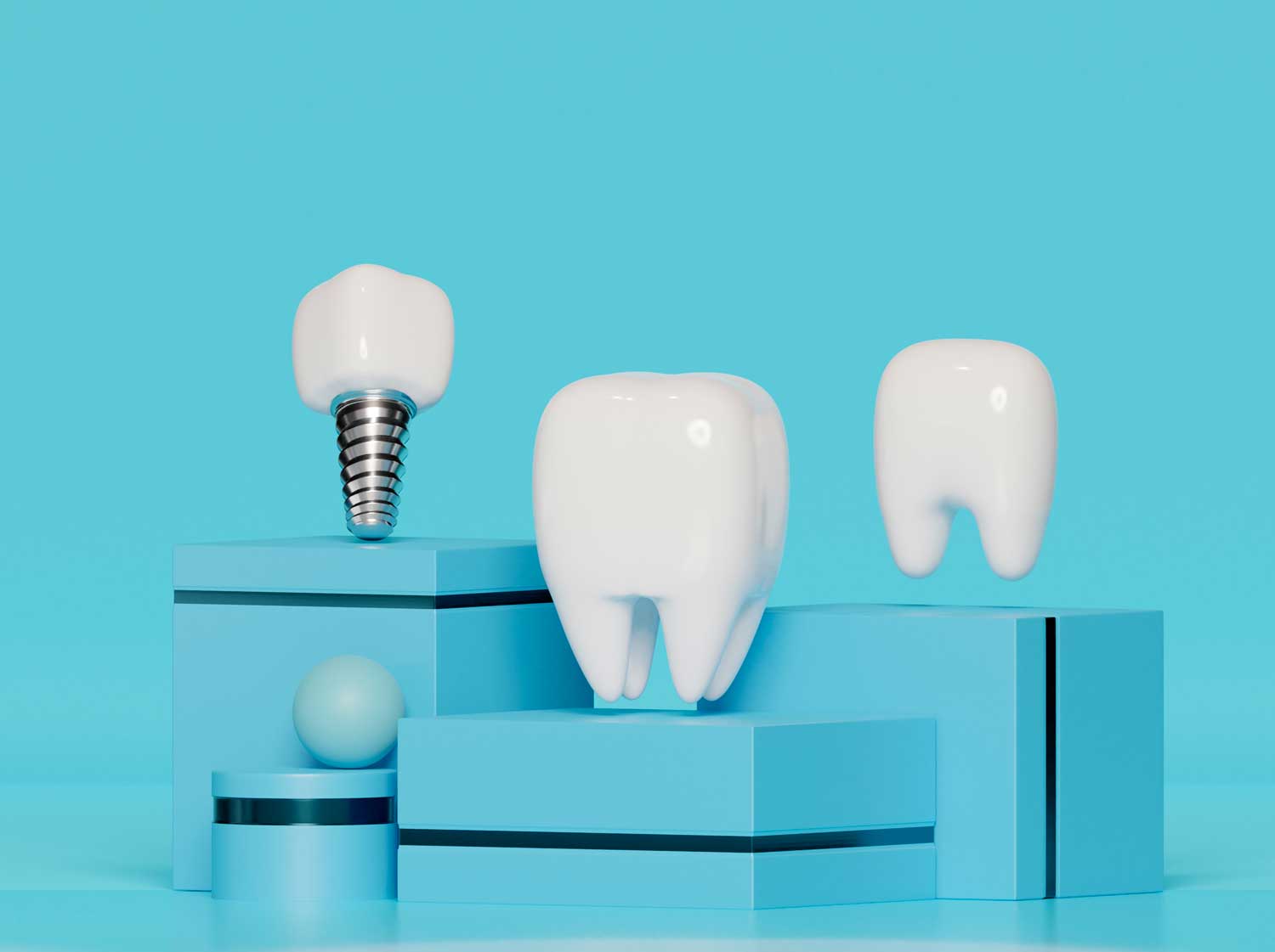 implant
